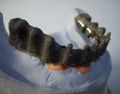 Fabrication de prothèse dentaire près de Louvain-la-Neuve