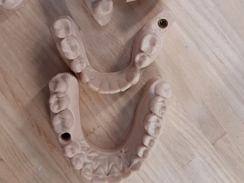 Réparation de dentier près de Louvain-la-Neuve